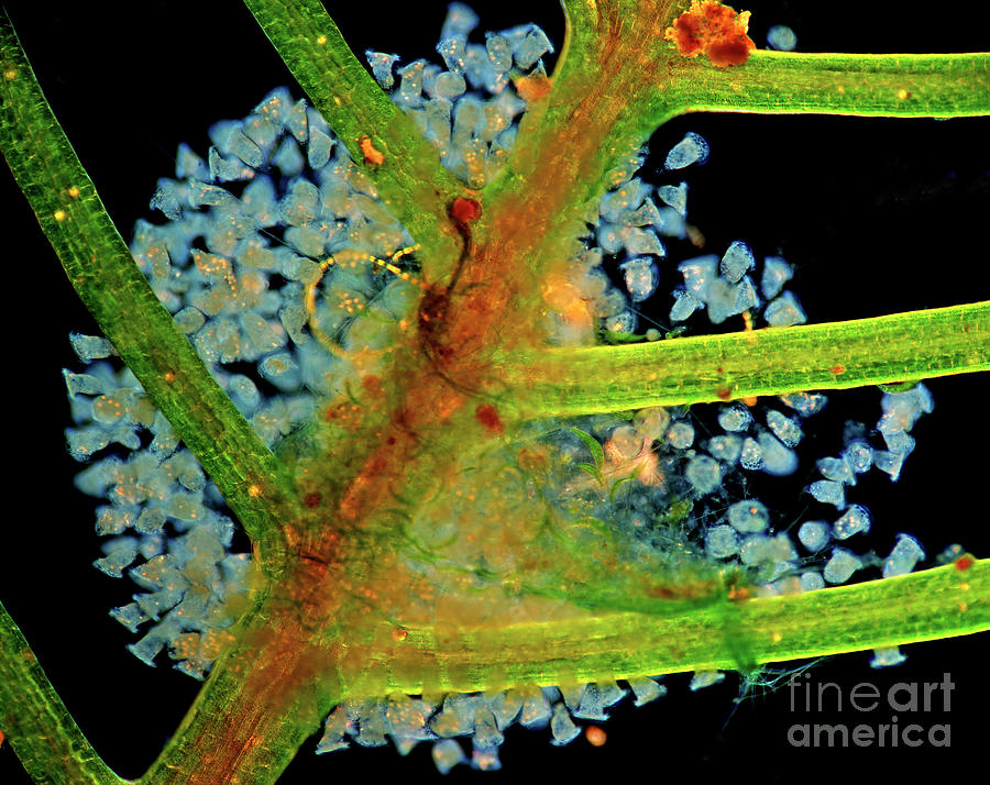 Vorticella Protozoa Photograph by Marek Mis/science Photo Library | Pixels