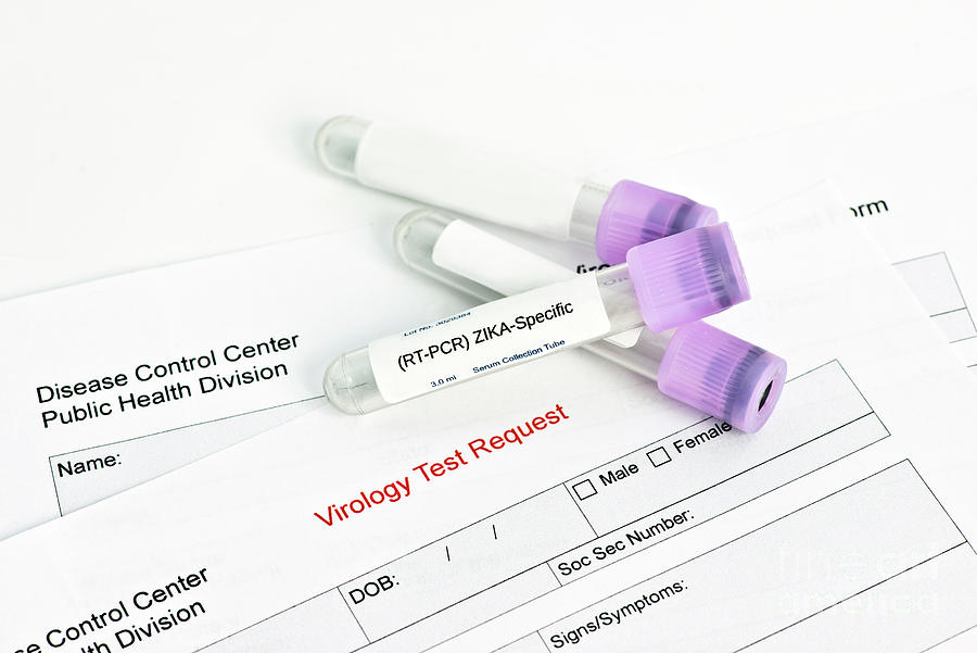 Zika Virus Lab Test Photograph by Sherry Yates Young/science Photo