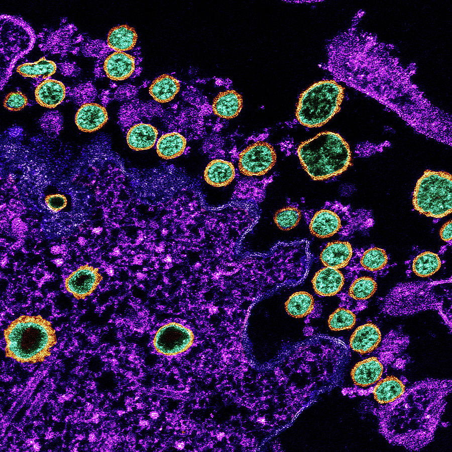 Sars-cov-2, Covid-19 Virus, Tem #50 Photograph by Science Source