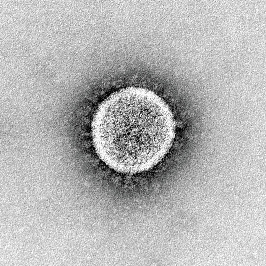 Sars-cov-2, Covid-19 Virus, Tem #51 Photograph by Science Source