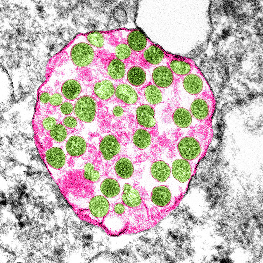 Sars-cov-2, Covid-19 Virus, Tem #56 Photograph by Science Source