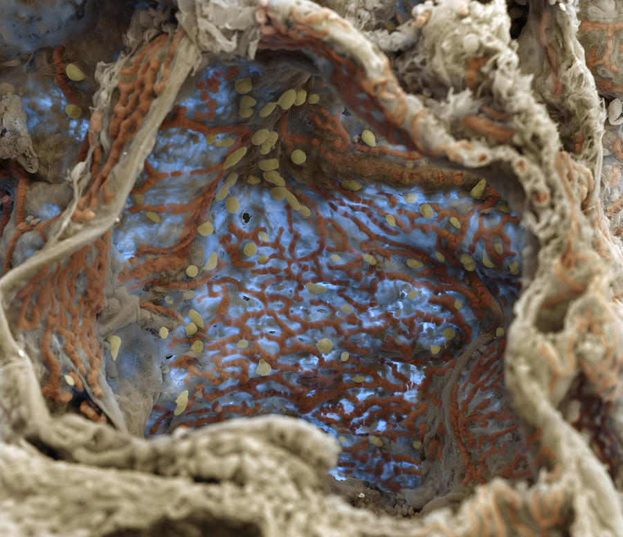 Alveoli With Capillaries, Sem #6 Photograph by Meckes/ottawa