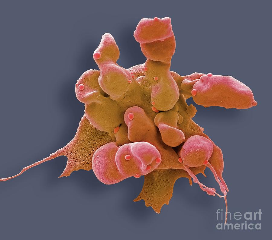 Apoptosis Photograph By Steve Gschmeissnerscience Photo Library Fine Art America