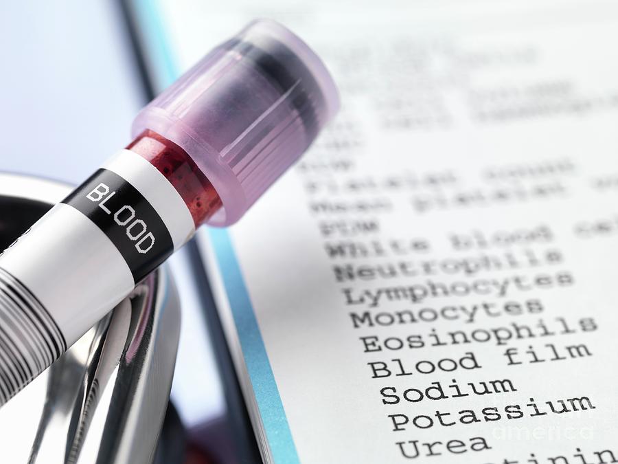 Blood Test Results #6 Photograph by Tek Image/science Photo Library
