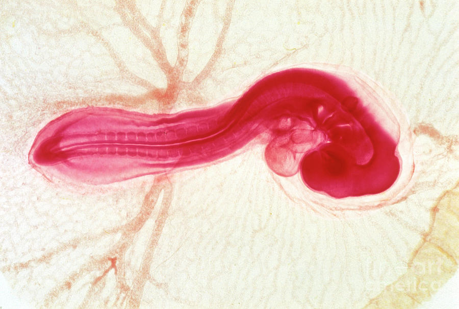Chicken Embryo #6 Photograph by Dr Keith Wheeler/science Photo Library