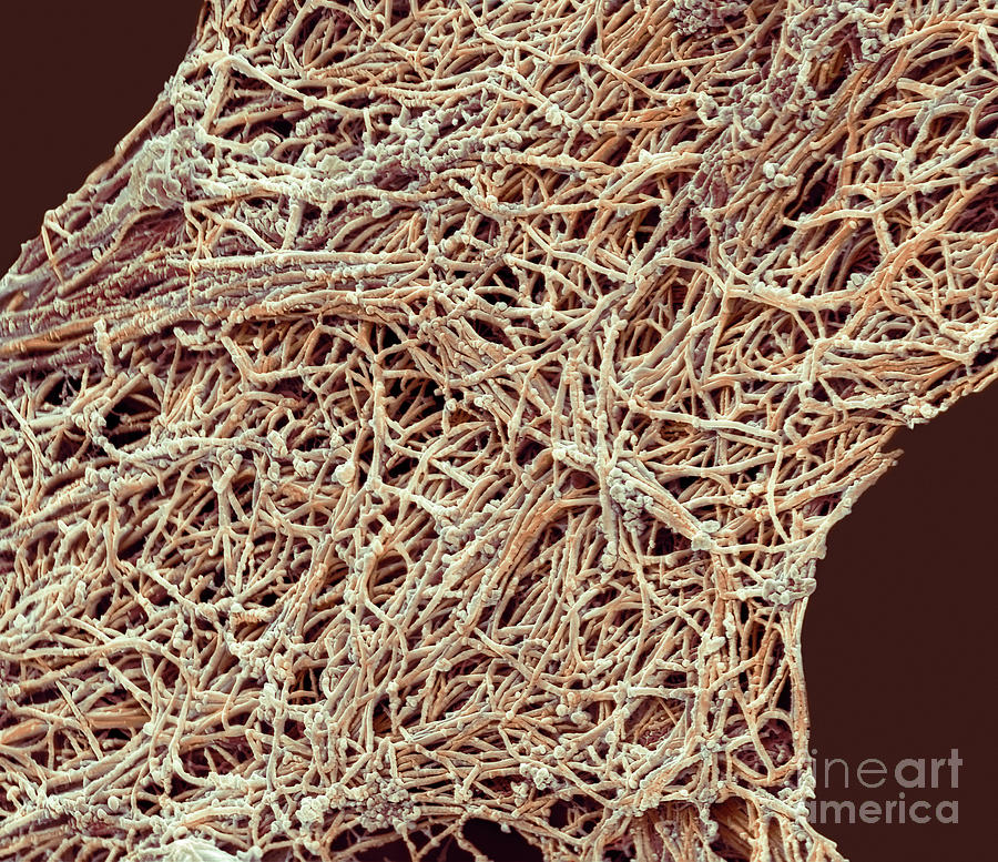 Collagen Fibres Photograph By Steve Gschmeissner Science Photo Library