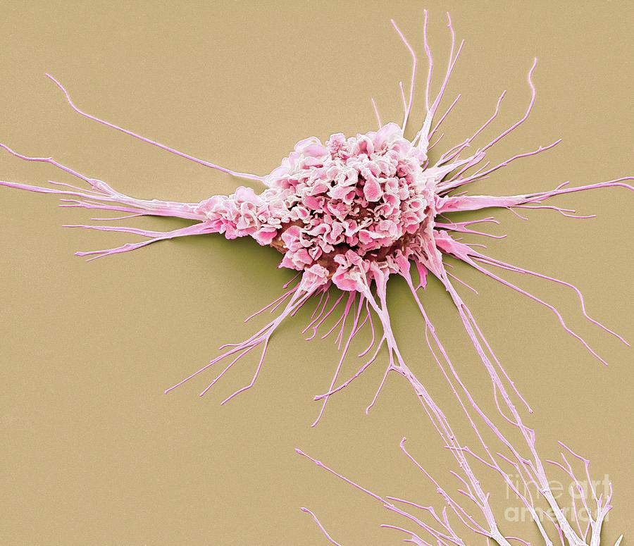 Dendritic Cell #6 Photograph by Steve Gschmeissner/science Photo Library