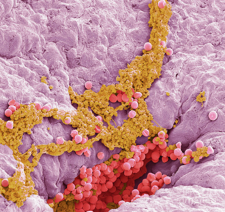 Early Clot Formation Photograph by Steve Gschmeissner/science Photo ...