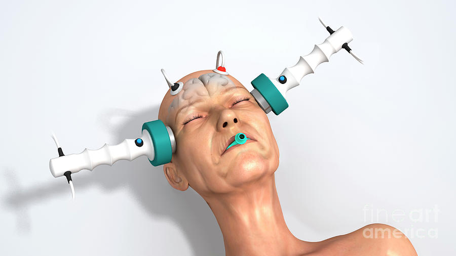Electroconvulsive Therapy (ECT)