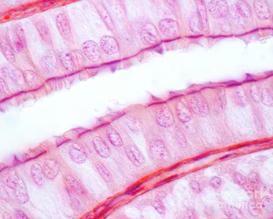 Fallopian Tube Ciliated Epithelium 6 By Jose Calvoscience Photo Library 