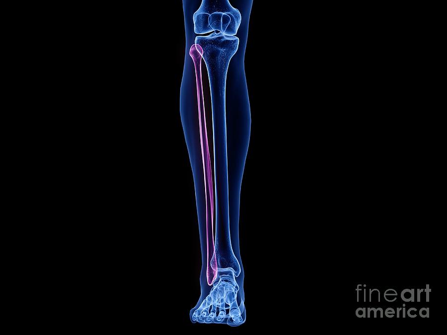 Fibula Bone #6 Photograph by Sebastian Kaulitzki/science Photo Library ...