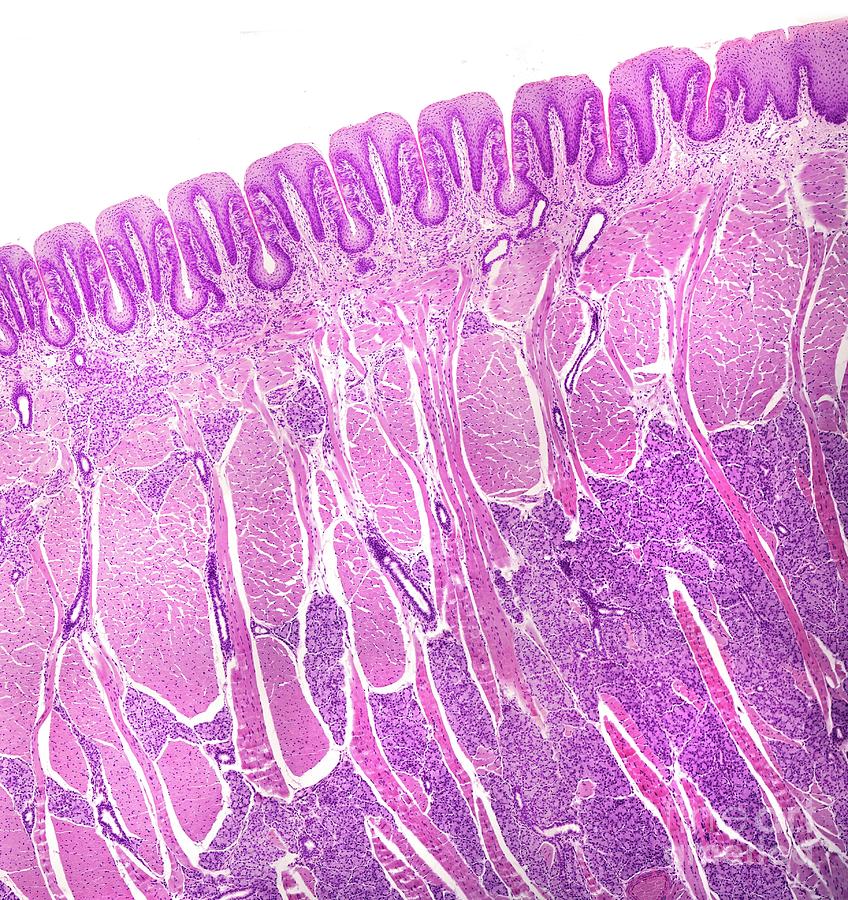 Foliate Papillae With Taste Buds #6 Photograph by Jose Calvo / Science Photo Library