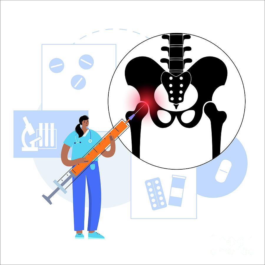 Hip Joint Injection Photograph by Pikovit / Science Photo Library ...