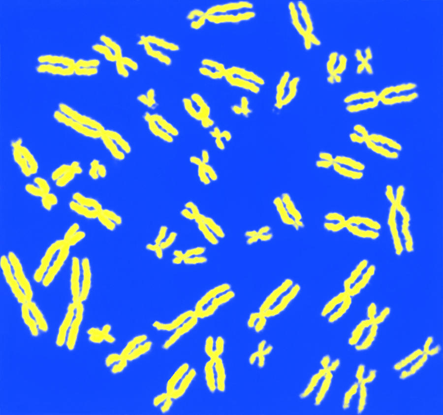 Human Chromosomes #6 Photograph by Biophoto Associates