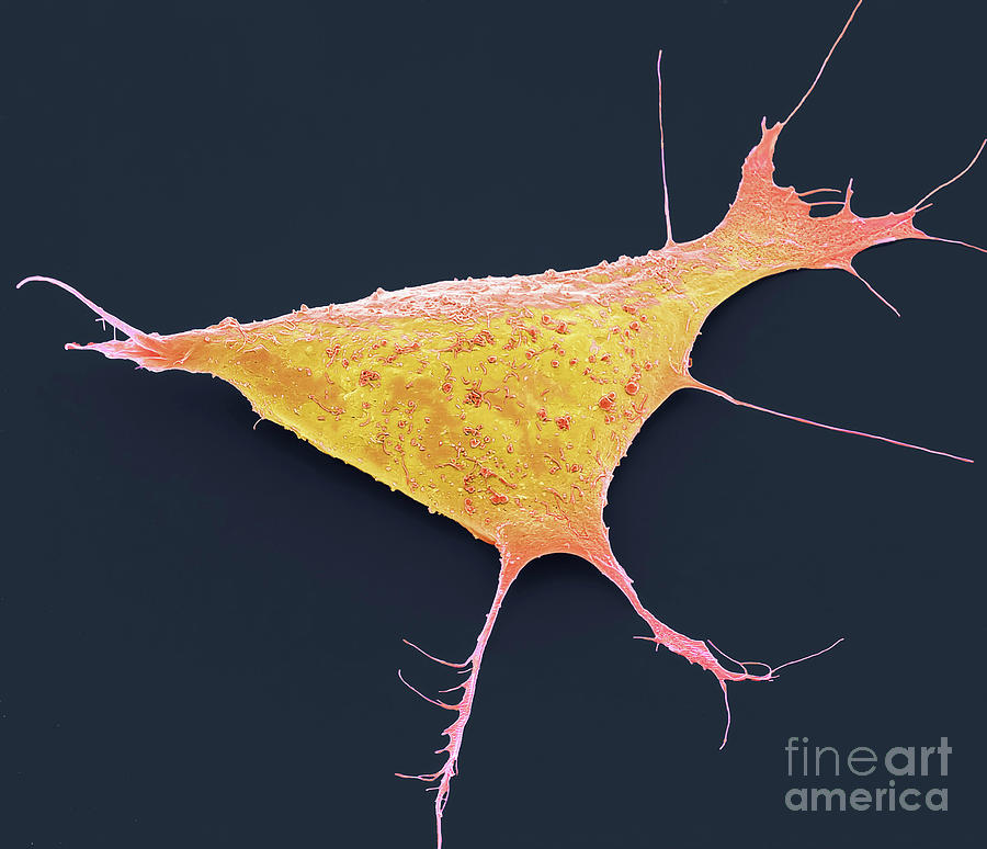 Human Induced Pluripotent Cell. #6 Photograph by Steve Gschmeissner/science Photo Library