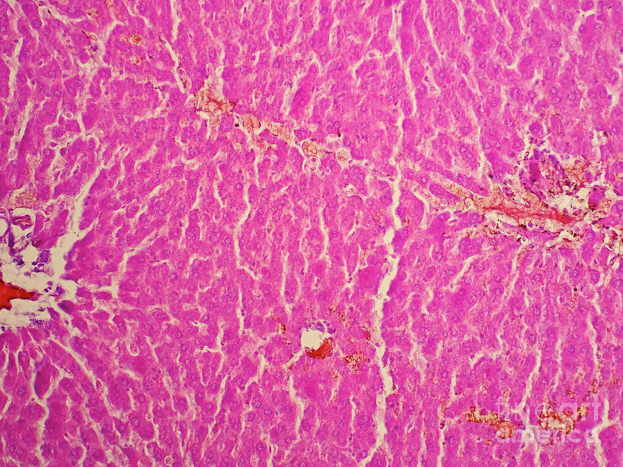 Human Liver Tissue Photograph by Choksawatdikorn / Science Photo ...