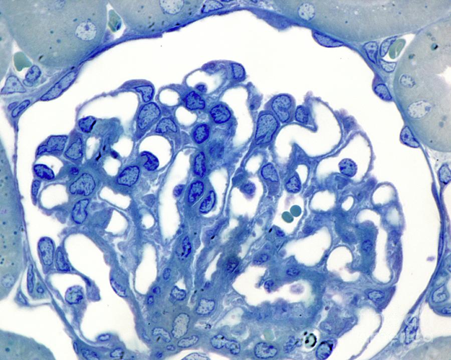 Kidney Glomerulus #6 Photograph by Jose Calvo/science Photo Library