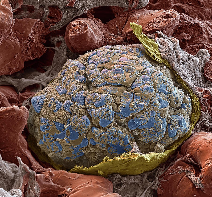 Kidney Glomerulus, Sem #6 Photograph by Oliver Meckes EYE OF SCIENCE