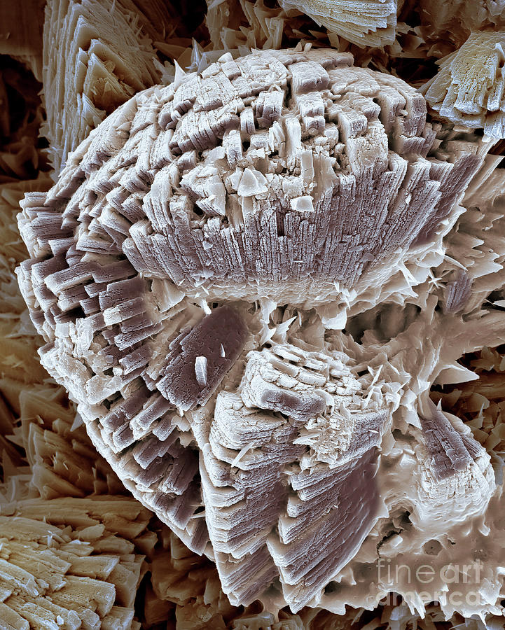 Kidney Stone #6 Photograph by Dennis Kunkel Microscopy/science Photo Library
