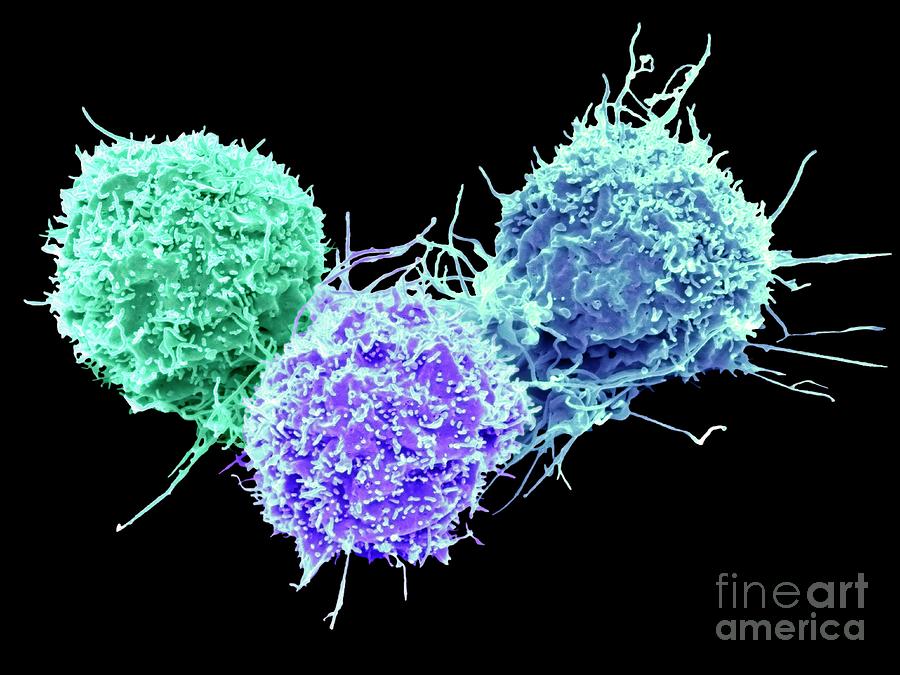 Lung Cancer Cells #6 Photograph by Steve Gschmeissner/science Photo Library