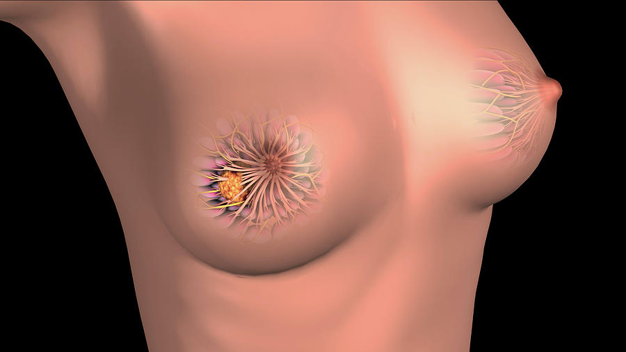 Medical Illustration Showing Breast #6 Photograph by Stocktrek Images