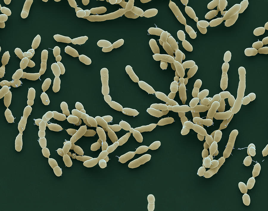 Pasteurella Sem Photograph by Meckes/ottawa Fine Art America