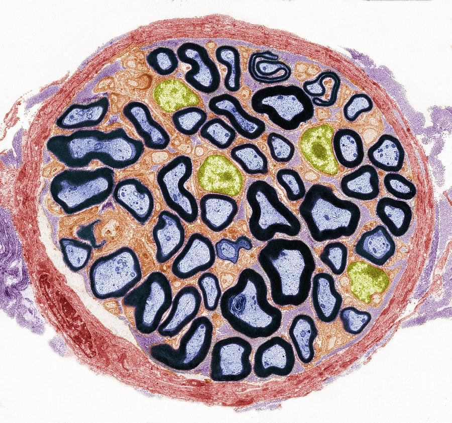 Peripheral Nerve #6 by Steve Gschmeissner/science Photo Library