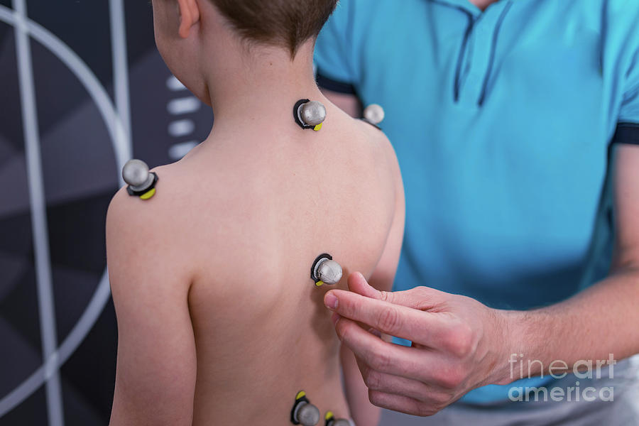 Sports Photograph - Placing Markers For Posture Analysis #6 by Microgen Images/science Photo Library