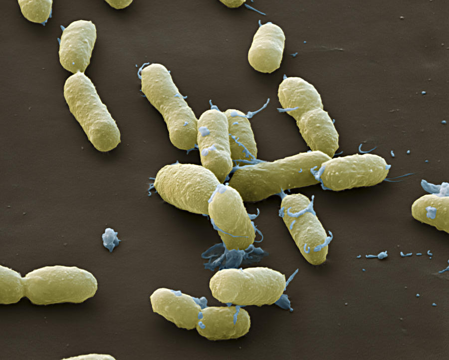 Plague Bacteria Yersinia Pestis, Sem #6 Photograph by Meckes/ottawa