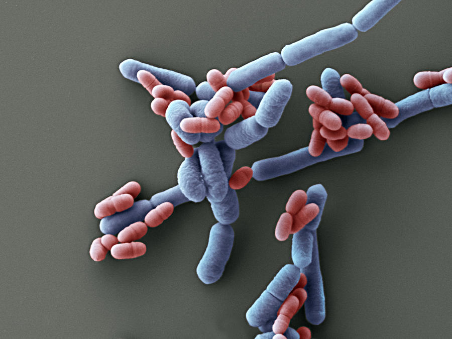 Probiotic Lactobacillis Bacteria Sem #6 Photograph by Meckes/ottawa