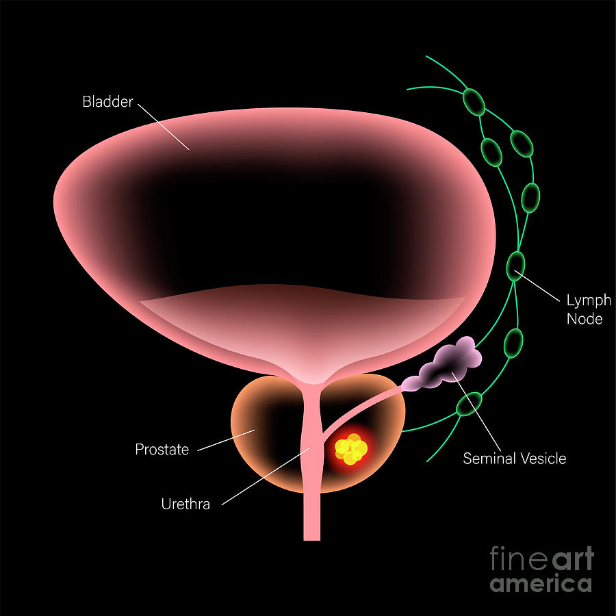 Prostatic Urethra