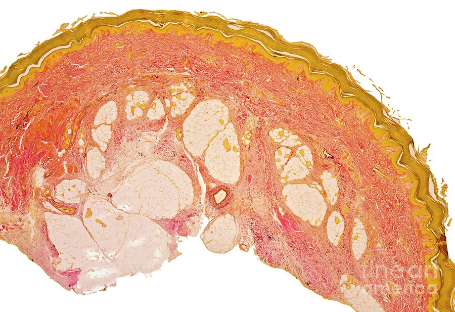 Skin #6 Photograph by Dr Keith Wheeler/science Photo Library