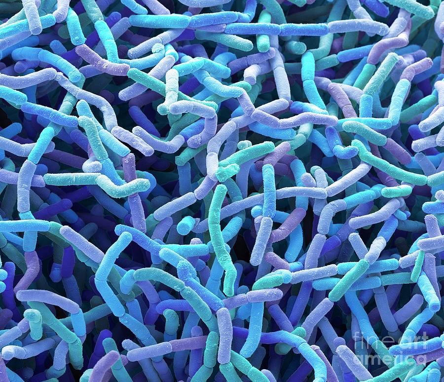 Soil Bacteria Photograph by Steve Gschmeissner/science Photo Library