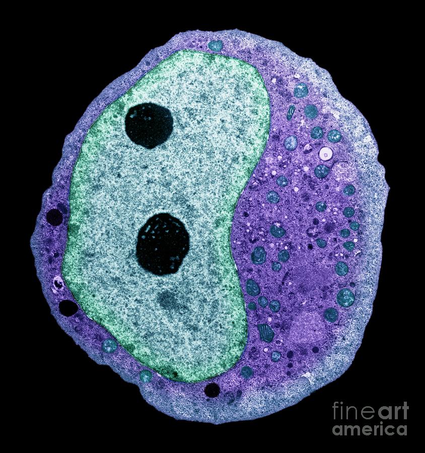 Testicular Cancer #6 Photograph by Steve Gschmeissner/science Photo Library