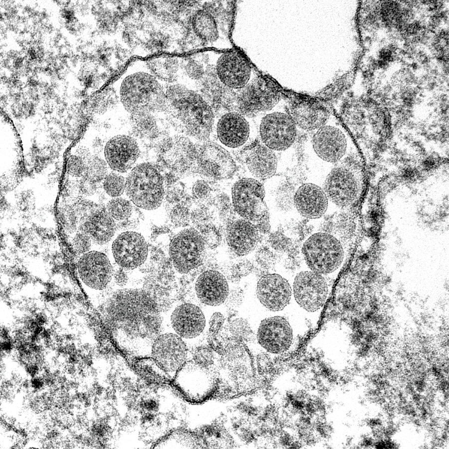 Sars-cov-2, Covid-19 Virus, Tem #60 Photograph by Science Source