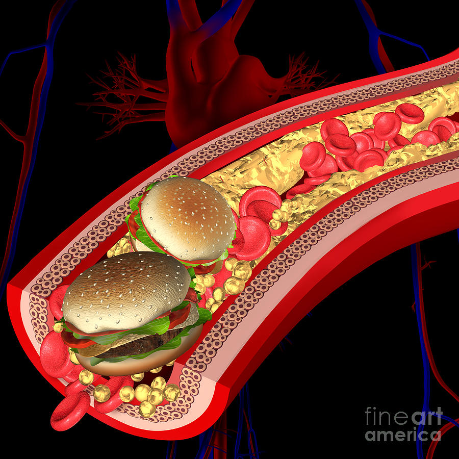 Cholesterol #65 Photograph by Science Photo Library Cholesterol #65 Photograph by Science Photo Library