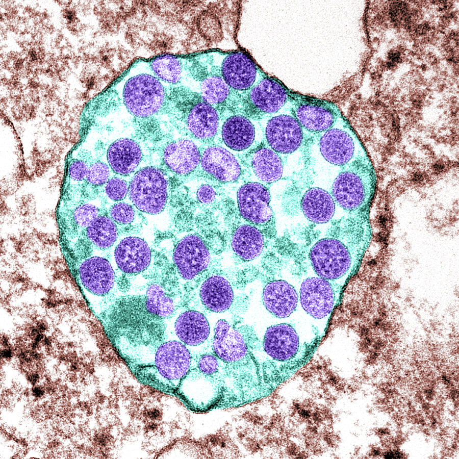 Sars-cov-2, Covid-19 Virus, Tem Photograph by Science Source - Fine Art ...