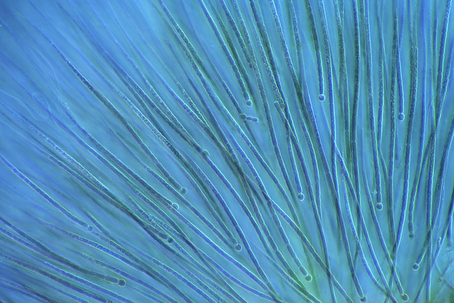 Rivularia Cyanobacteria, Lm Photograph by Marek Mis