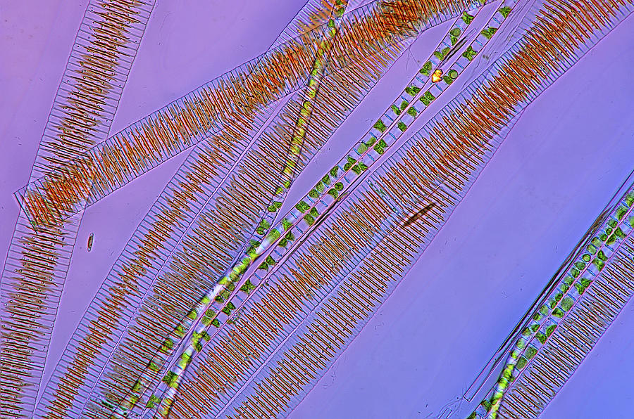 Diatoms And Filamentous Green Algae, Lm #1 Photograph by Marek Mis