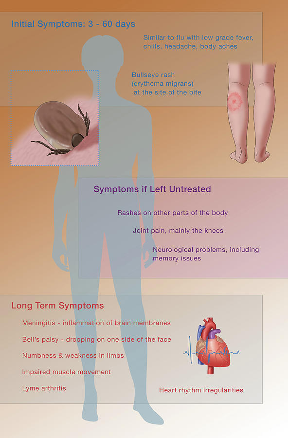Lyme Disease Symptoms Drawing by Monica Schroeder