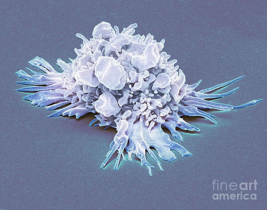 Activated T Lymphocyte #7 Photograph by Steve Gschmeissner/science Photo Library