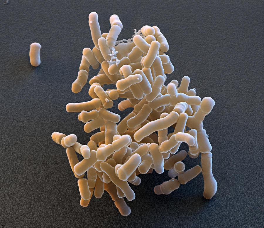 Bifidobacterium Breve, Sem Photograph By Meckes/ottawa - Pixels