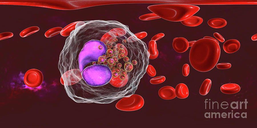 Blood Smear With Numerous Eosinophils Photograph by Kateryna Kon ...