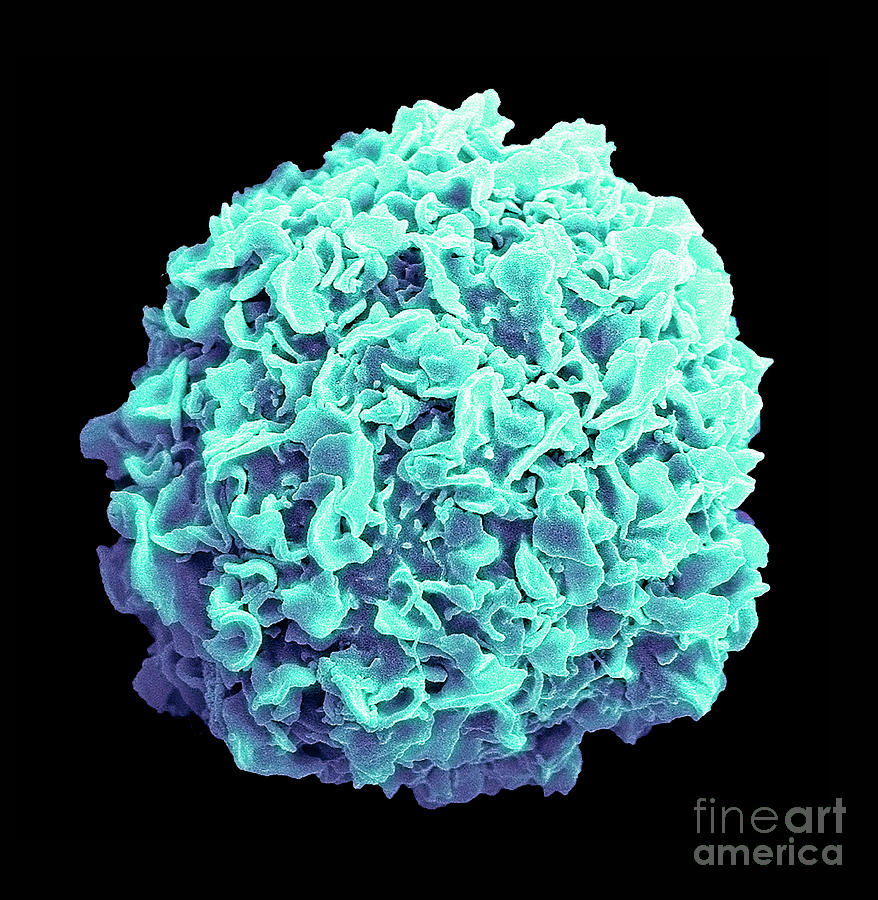 Breast Cancer Cell #7 Photograph by Steve Gschmeissner/science Photo Library