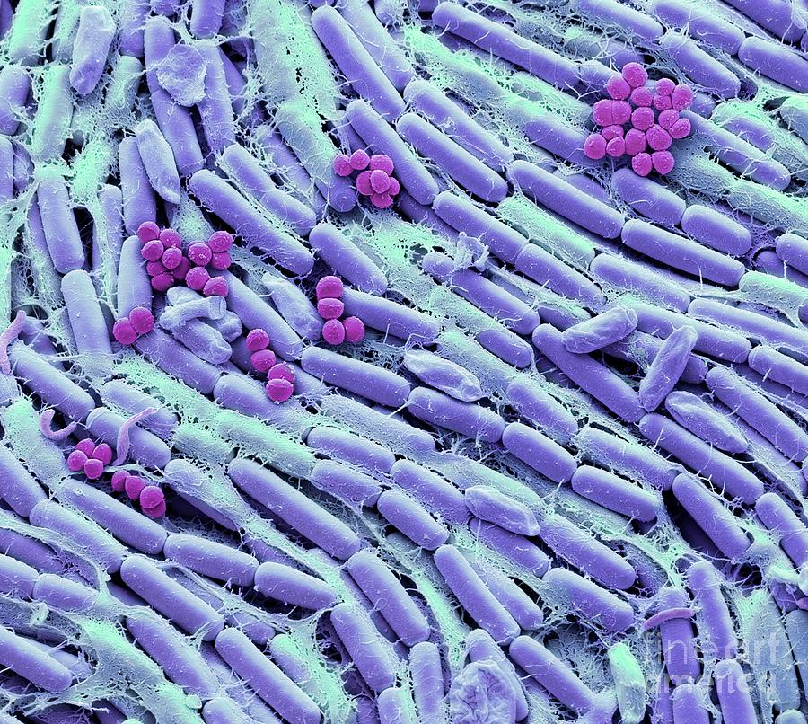 Breast Milk Bacteria #7 Photograph by Steve Gschmeissner/science Photo Library