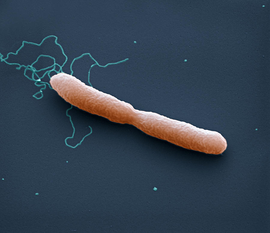 Burkholderi Pseudomallei Bacteria #7 Photograph by Meckes/ottawa