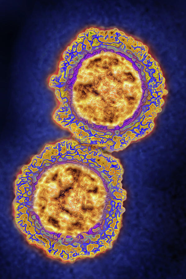 Coronavirus, Tem #7 Photograph by James Cavallini
