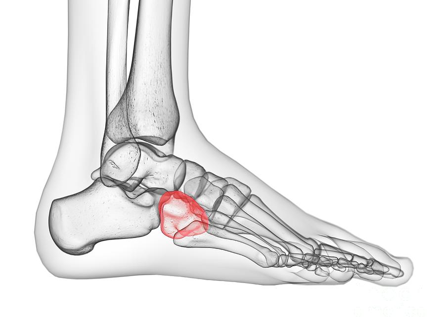 Cuboid Bone Photograph by Sebastian Kaulitzki/science Photo Library ...