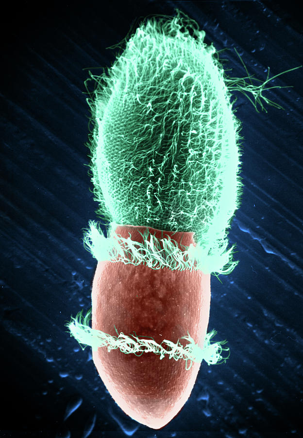 Didinium Attacking Paramecium, Sem #7 Photograph by Greg Antipa