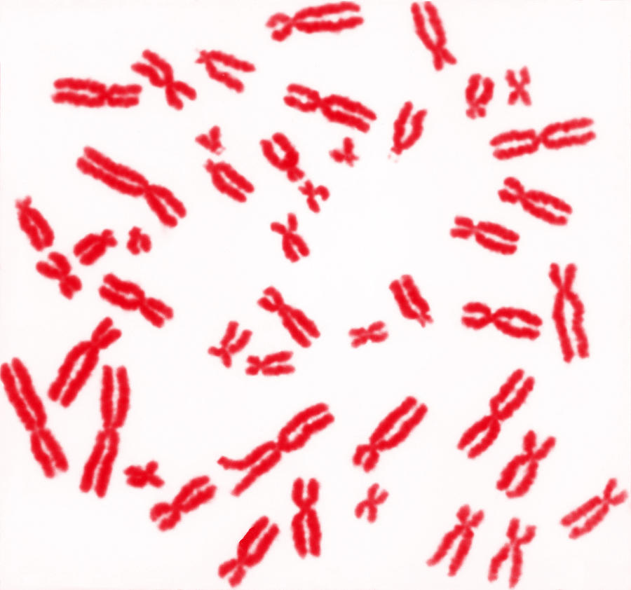 Human Chromosomes #7 Photograph by Biophoto Associates